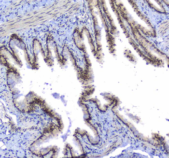 Anti-splicing factor 1/SF1 Antibody