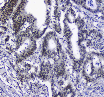 Anti-splicing factor 1/SF1 Antibody