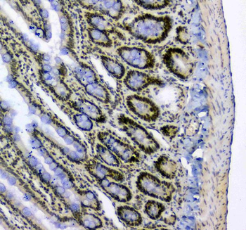 Anti-splicing factor 1/SF1 Antibody