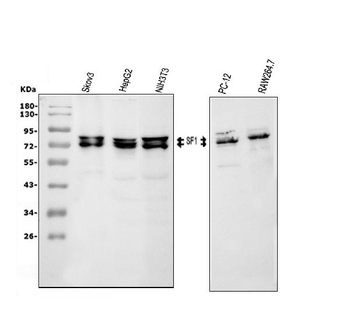 Anti-splicing factor 1/SF1 Antibody