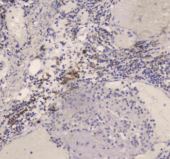 Anti-DC-SIGN/CD209 Antibody