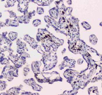 Anti-DC-SIGN/CD209 Antibody