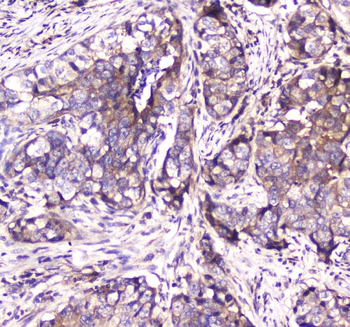 Anti-SDHB Antibody