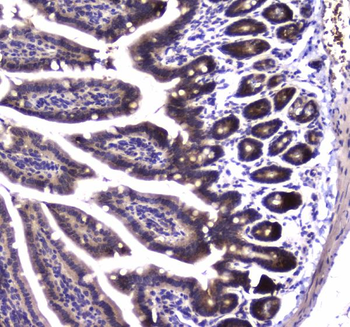 Anti-SDHB Antibody