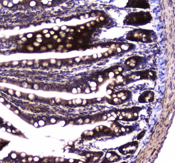 Anti-SDHB Antibody