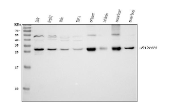 Anti-SDHB Antibody