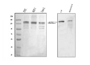 Anti-ASXL1 Antibody