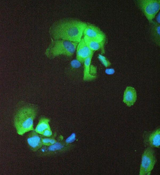 Anti-14-3-3 sigma/SFN Antibody
