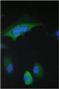Anti-14-3-3 sigma/SFN Antibody