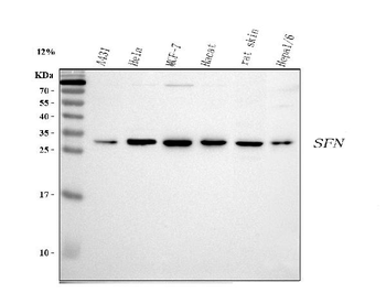 Anti-14-3-3 sigma/SFN Antibody