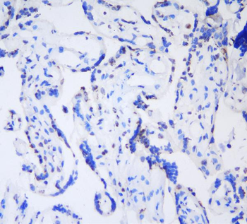 Anti-HP1 gamma/CBX3 Antibody