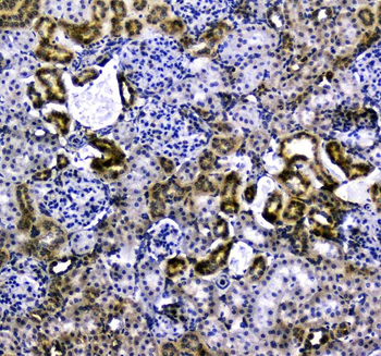 Anti-VCAM1 Antibody