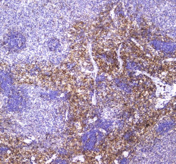 Anti-VCAM1 Antibody