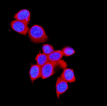 Anti-STUB1 Antibody