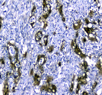 Anti-STUB1 Antibody