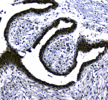 Anti-STUB1 Antibody