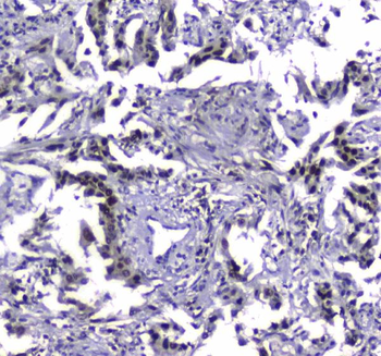 Anti-MDC1 Antibody