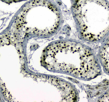 Anti-MDC1 Antibody
