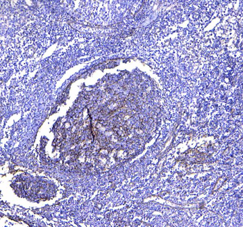 Anti-TAPA1/CD81 Antibody