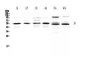 Retinoid X Receptor alpha/RXRA Antibody
