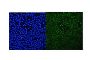 Anti-Retinoid X Receptor alpha/RXRA Antibody