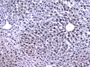 Anti-Retinoid X Receptor alpha/RXRA Antibody