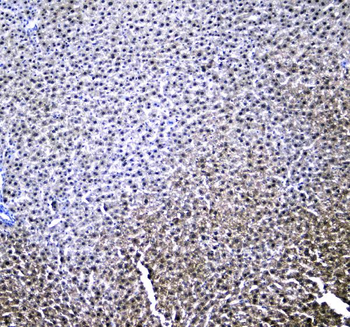 Anti-Retinoid X Receptor alpha/RXRA Antibody