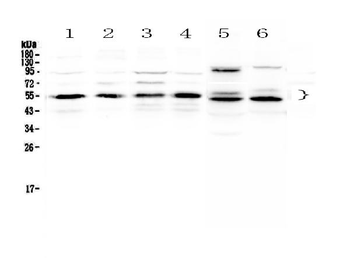 Anti-Retinoid X Receptor alpha/RXRA Antibody