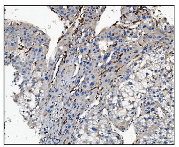 Anti-CD16/FCGR3A Antibody