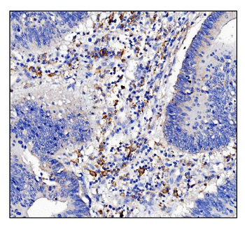 Anti-CD16/FCGR3A Antibody