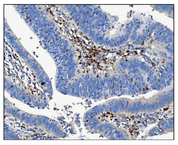Anti-CD16/FCGR3A Antibody