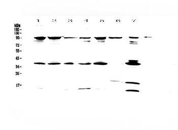 FES Rabbit Polyclonal Antibody