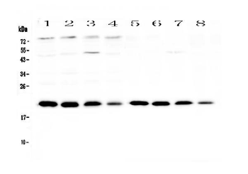 Anti-BNIP3 Antibody