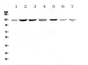 SMC6L1 Antibody