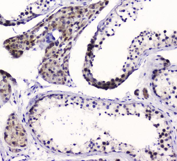 Anti-SMC6L1 Antibody