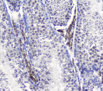 Anti-SMC6L1 Antibody