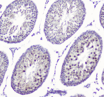 Anti-SMC6L1 Antibody