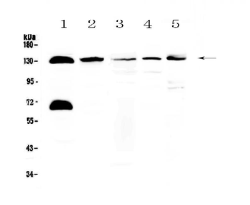 Anti-NEDD4-2/NEDD4L Antibody