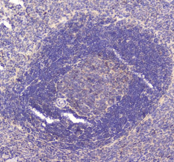 Anti-RAB27A Antibody