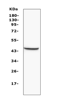 Anti-MVD Antibody