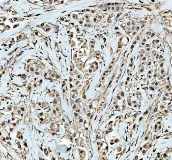 Anti-DCK Antibody