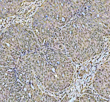 Anti-DCK Antibody