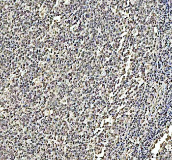 Anti-DCK Antibody