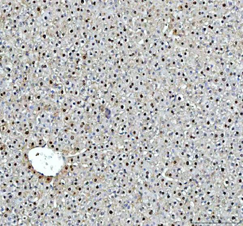 Anti-DCK Antibody