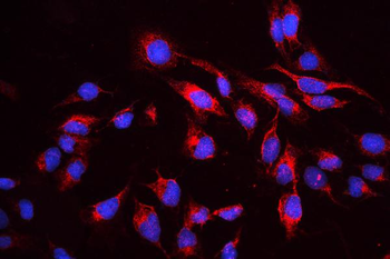 Anti-cIAP1/BIRC2 Antibody