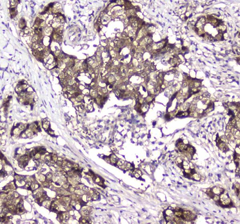 Anti-GLO1 Antibody