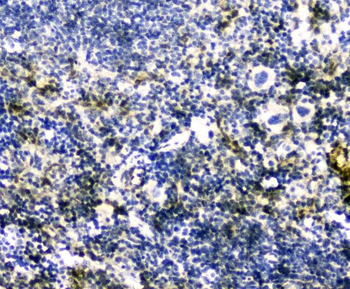 Anti-GLO1 Antibody