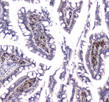 Anti-GLO1 Antibody