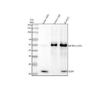 Anti-GLO1 Antibody