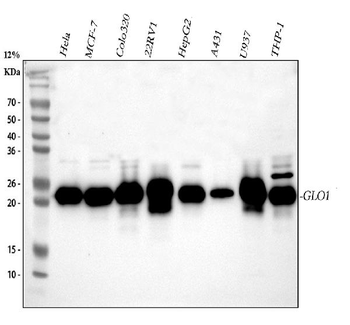 Anti-GLO1 Antibody